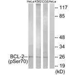 Western Blot - Anti-BCL-2 (phospho Ser70) Antibody (A7025) - Antibodies.com