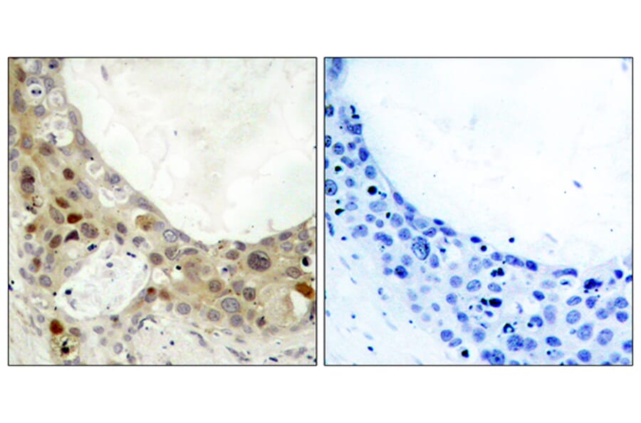 Immunohistochemistry - Anti-BCL-2 (phospho Ser70) Antibody (A7025) - Antibodies.com