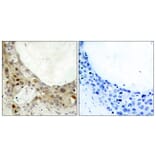Immunohistochemistry - Anti-BCL-2 (phospho Ser70) Antibody (A7025) - Antibodies.com