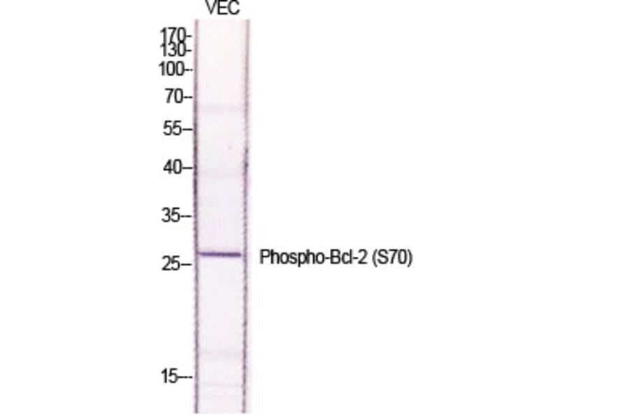 Western Blot - Anti-BCL-2 (phospho Ser70) Antibody (A7025) - Antibodies.com