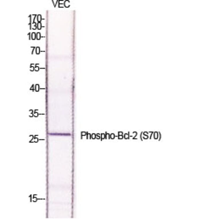 Western Blot - Anti-BCL-2 (phospho Ser70) Antibody (A7025) - Antibodies.com
