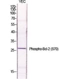Western Blot - Anti-BCL-2 (phospho Ser70) Antibody (A7025) - Antibodies.com