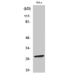 Western Blot - Anti-BCL-2 (phospho Ser70) Antibody (A7025) - Antibodies.com