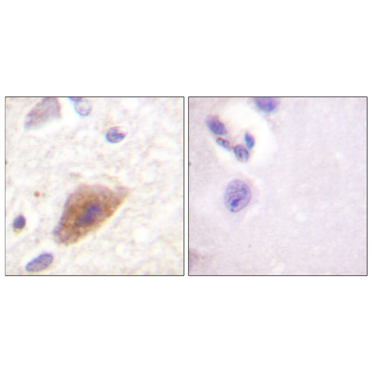 Immunohistochemistry - Anti-Tyrosine Hydroxylase Antibody (B0592) - Antibodies.com