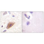 Immunohistochemistry - Anti-Tyrosine Hydroxylase Antibody (B0592) - Antibodies.com