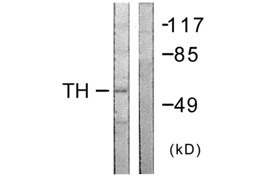 Western Blot - Anti-Tyrosine Hydroxylase Antibody (B0592) - Antibodies.com