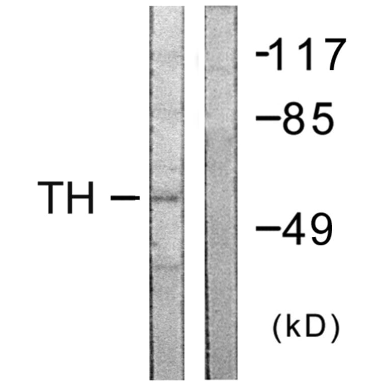 Western Blot - Anti-Tyrosine Hydroxylase Antibody (B0592) - Antibodies.com