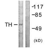 Western Blot - Anti-Tyrosine Hydroxylase Antibody (B0592) - Antibodies.com