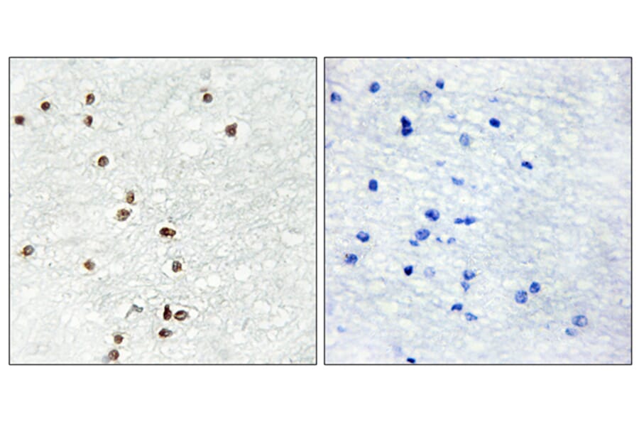 Immunohistochemistry - Anti-ZIC1 + ZIC2 + ZIC3 Antibody (C10137) - Antibodies.com