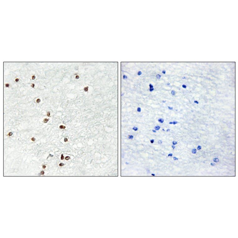 Immunohistochemistry - Anti-ZIC1 + ZIC2 + ZIC3 Antibody (C10137) - Antibodies.com