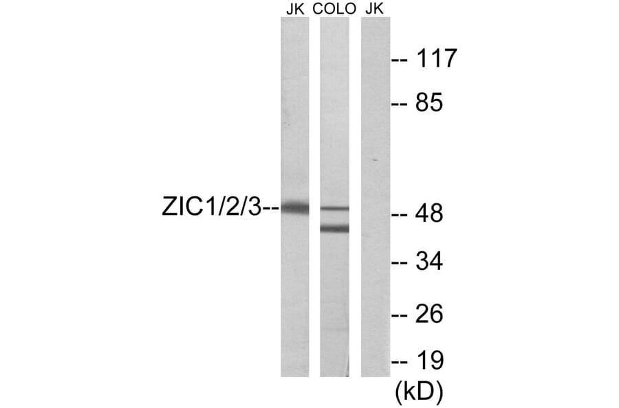 Western Blot - Anti-ZIC1 + ZIC2 + ZIC3 Antibody (C10137) - Antibodies.com