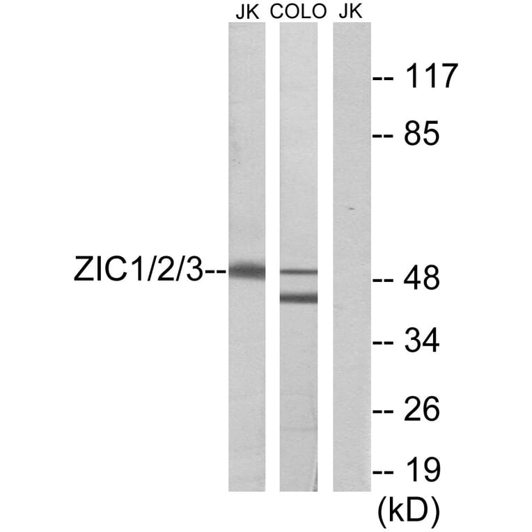 Western Blot - Anti-ZIC1 + ZIC2 + ZIC3 Antibody (C10137) - Antibodies.com