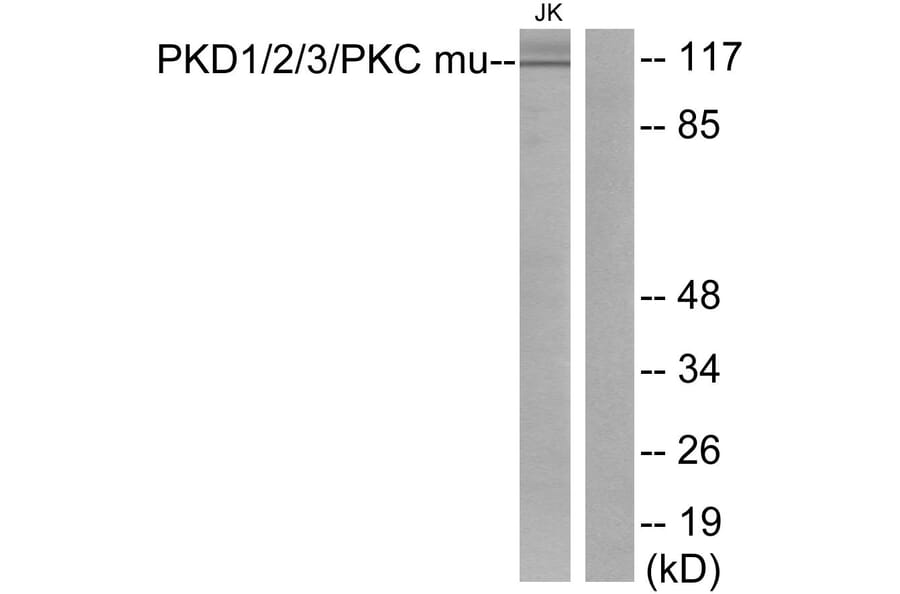 Western Blot - Anti-PKD1 + PKD2 + PKD3 Antibody (B0720) - Antibodies.com
