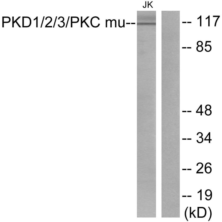 Western Blot - Anti-PKD1 + PKD2 + PKD3 Antibody (B0720) - Antibodies.com