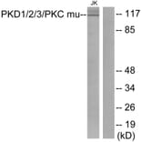 Western Blot - Anti-PKD1 + PKD2 + PKD3 Antibody (B0720) - Antibodies.com