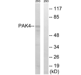 Western Blot - Anti-PAK4 + PAK5 + PAK6 Antibody (B0708) - Antibodies.com