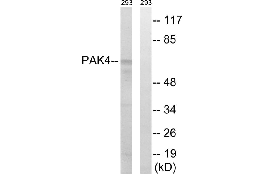 Western Blot - Anti-PAK4 + PAK5 + PAK6 Antibody (B0708) - Antibodies.com