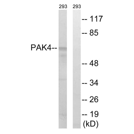 Western Blot - Anti-PAK4 + PAK5 + PAK6 Antibody (B0708) - Antibodies.com
