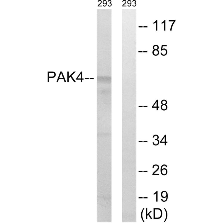 Western Blot - Anti-PAK4 + PAK5 + PAK6 Antibody (B0708) - Antibodies.com