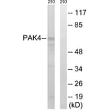 Western Blot - Anti-PAK4 + PAK5 + PAK6 Antibody (B0708) - Antibodies.com