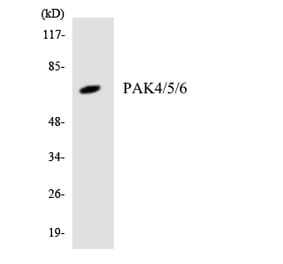 Western Blot - Anti-PAK4 + PAK5 + PAK6 Antibody (R12-3300) - Antibodies.com