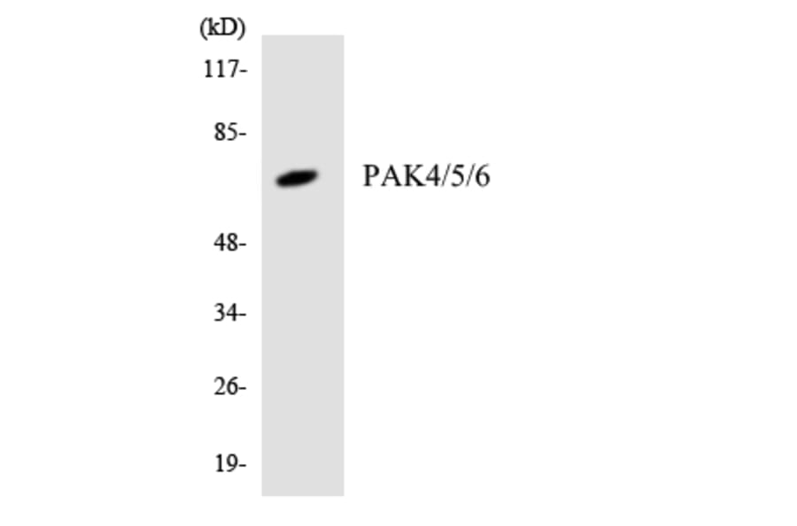 Western Blot - Anti-PAK4 + PAK5 + PAK6 Antibody (R12-3300) - Antibodies.com