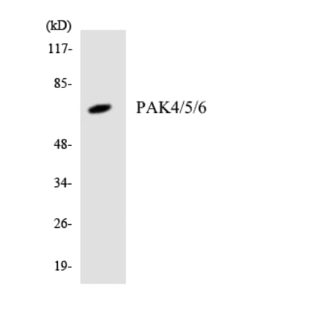 Western Blot - Anti-PAK4 + PAK5 + PAK6 Antibody (R12-3300) - Antibodies.com