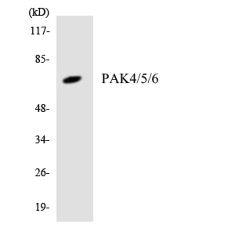 Western Blot - Anti-PAK4 + PAK5 + PAK6 Antibody (R12-3300) - Antibodies.com