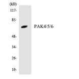 Western Blot - Anti-PAK4 + PAK5 + PAK6 Antibody (R12-3300) - Antibodies.com