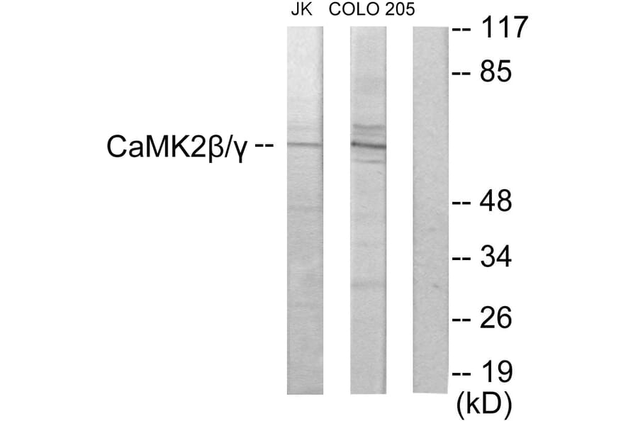 Western Blot - Anti-CaMK2 beta + gamma Antibody (C10992) - Antibodies.com