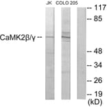 Western Blot - Anti-CaMK2 beta + gamma Antibody (C10992) - Antibodies.com