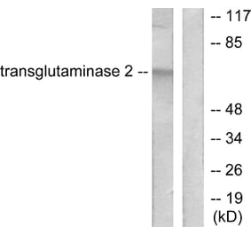 Western Blot - Anti-Transglutaminase 2 Antibody (C0350) - Antibodies.com
