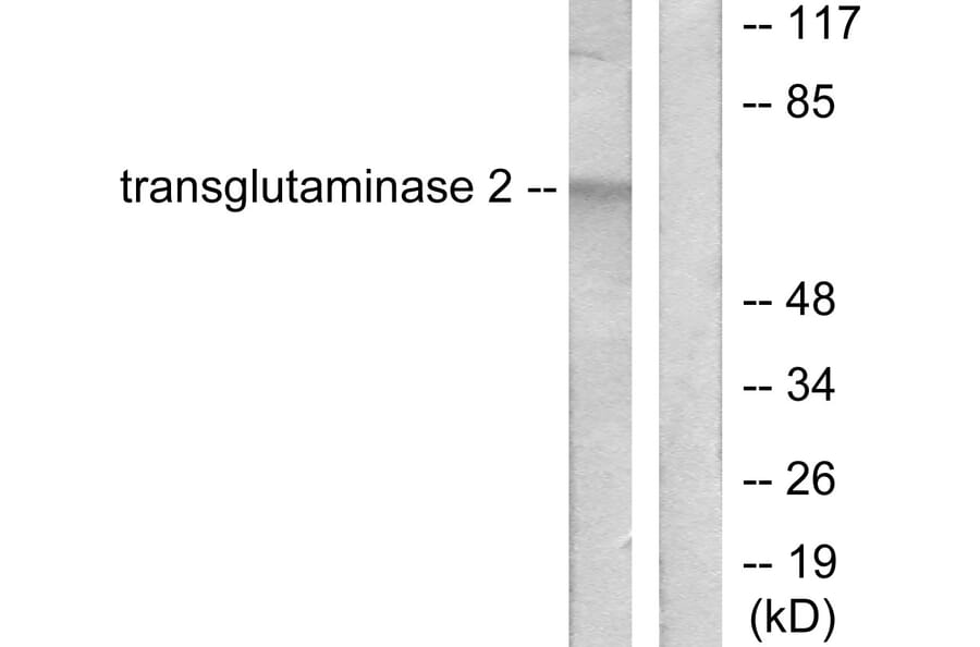 Western Blot - Anti-Transglutaminase 2 Antibody (C0350) - Antibodies.com