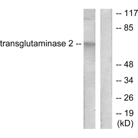 Western Blot - Anti-Transglutaminase 2 Antibody (C0350) - Antibodies.com