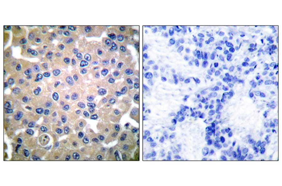 Immunohistochemistry - Anti-Transglutaminase 2 Antibody (C0350) - Antibodies.com