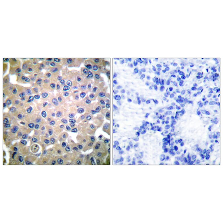 Immunohistochemistry - Anti-Transglutaminase 2 Antibody (C0350) - Antibodies.com