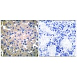 Immunohistochemistry - Anti-Transglutaminase 2 Antibody (C0350) - Antibodies.com