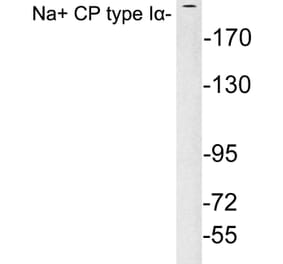 Western Blot - Anti-Na+ CP type Ialpha Antibody (R12-2249) - Antibodies.com