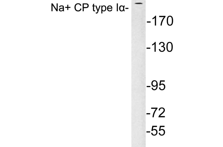 Western Blot - Anti-Na+ CP type Ialpha Antibody (R12-2249) - Antibodies.com