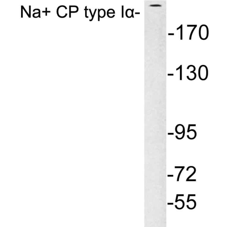 Western Blot - Anti-Na+ CP type Ialpha Antibody (R12-2249) - Antibodies.com