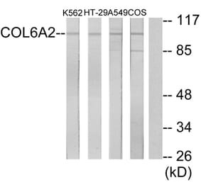 Western Blot - Anti-Collagen VI alpha2 Antibody (C12205) - Antibodies.com