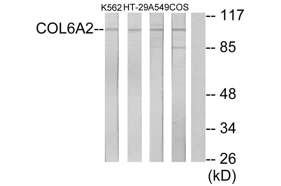 Western Blot - Anti-Collagen VI alpha2 Antibody (C12205) - Antibodies.com