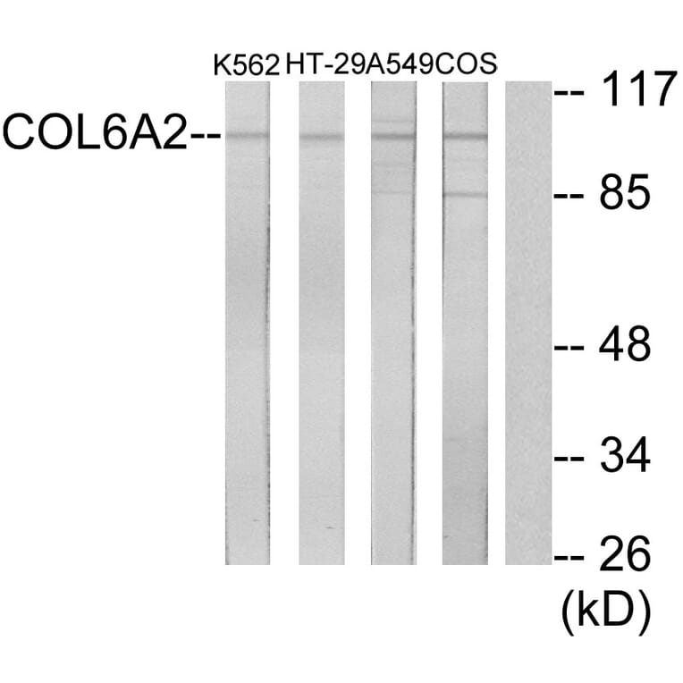 Western Blot - Anti-Collagen VI alpha2 Antibody (C12205) - Antibodies.com