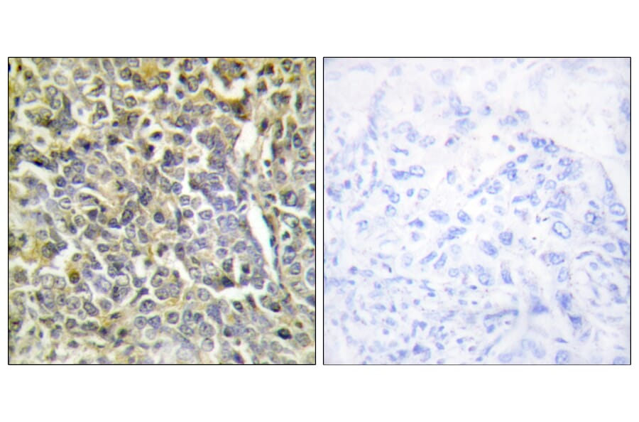 Immunohistochemistry - Anti-Collagen VI alpha2 Antibody (C12205) - Antibodies.com
