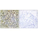 Immunohistochemistry - Anti-Collagen VI alpha2 Antibody (C12205) - Antibodies.com