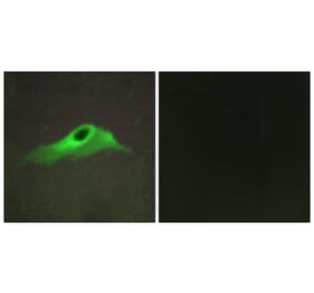 Immunofluorescence - Anti-Collagen IV alpha5 Antibody (C12199) - Antibodies.com