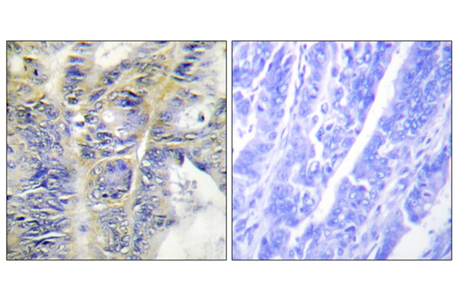 Immunohistochemistry - Anti-Collagen IV alpha5 Antibody (C12199) - Antibodies.com