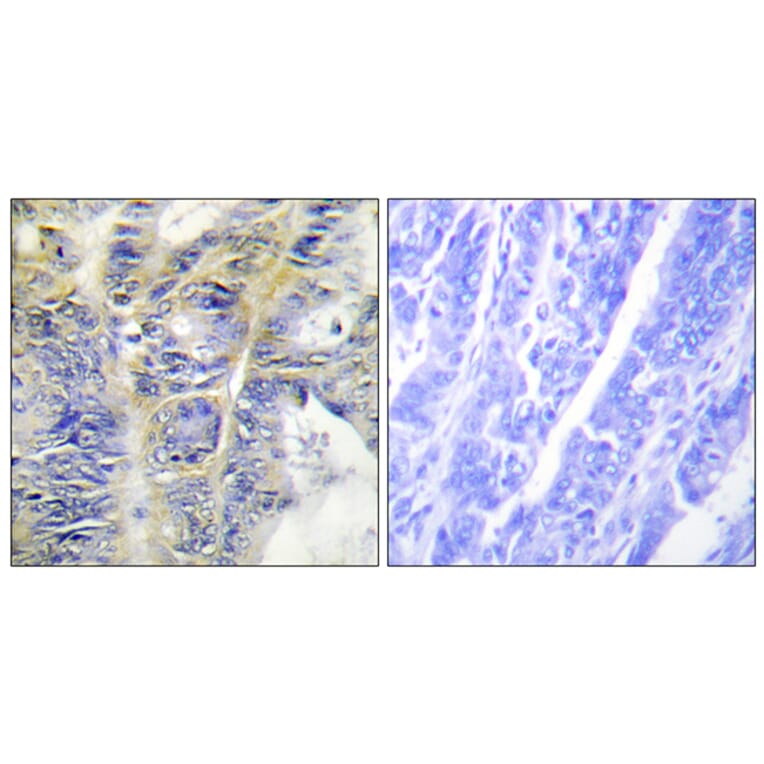 Immunohistochemistry - Anti-Collagen IV alpha5 Antibody (C12199) - Antibodies.com