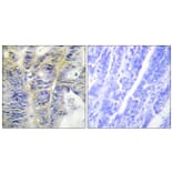 Immunohistochemistry - Anti-Collagen IV alpha5 Antibody (C12199) - Antibodies.com