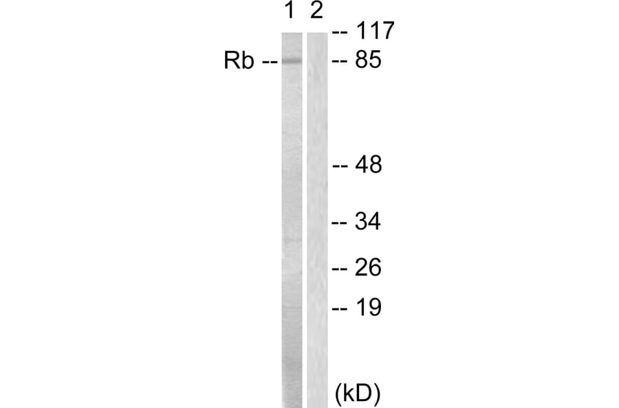 Western Blot - Anti-Retinoblastoma Antibody (B0810) - Antibodies.com